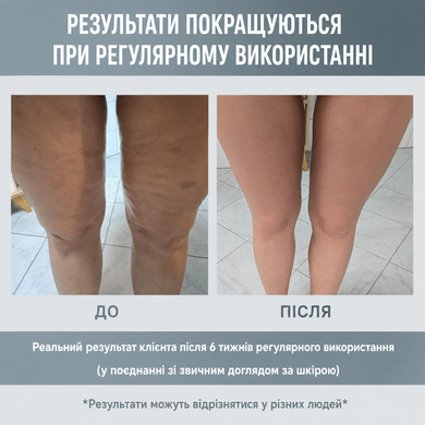 Ручной роликовый массажер для тела с двумя ручками и съемным роликом Roller Massager мультиколор 3487 фото